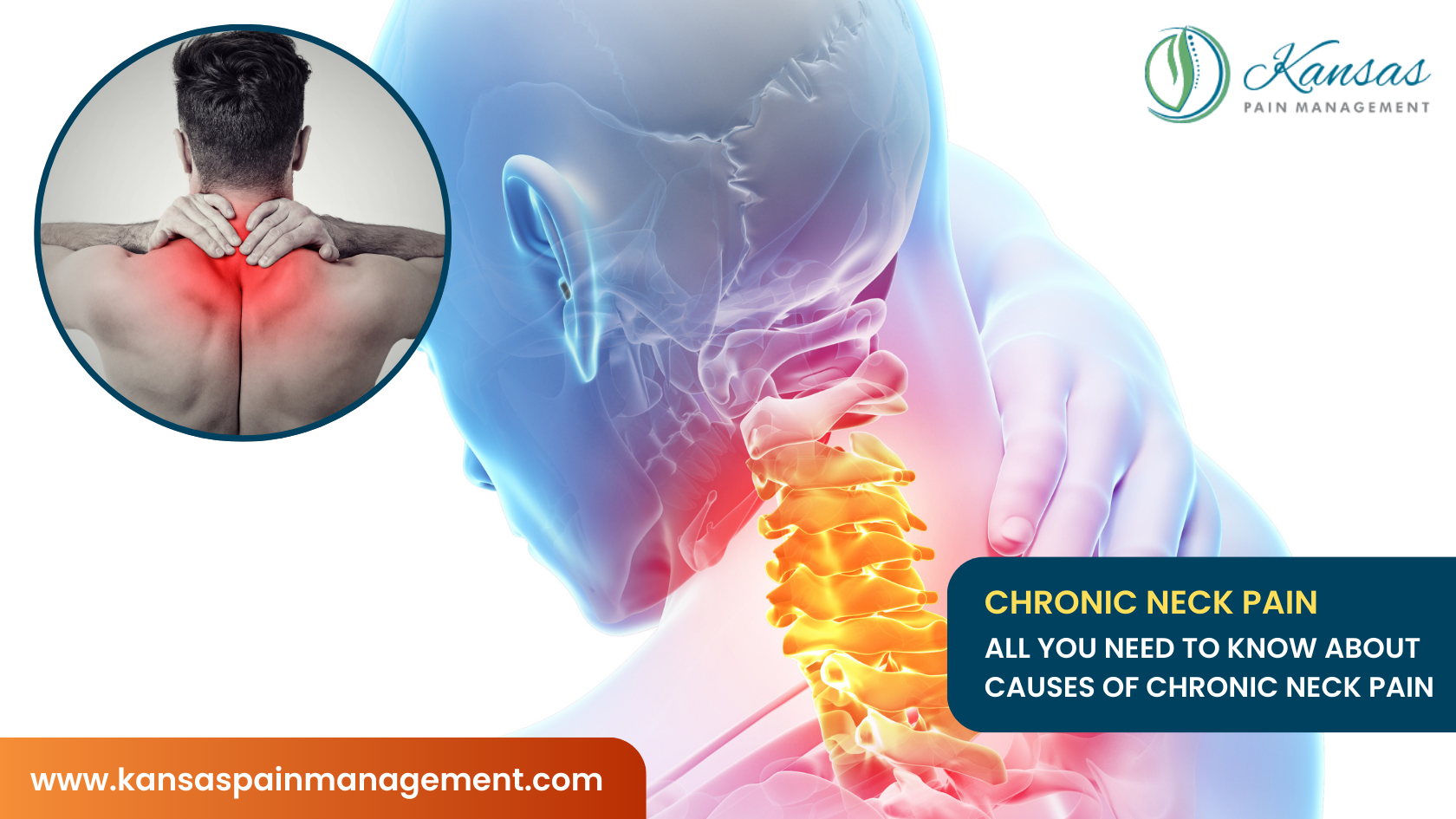 Chronic Neck Pain