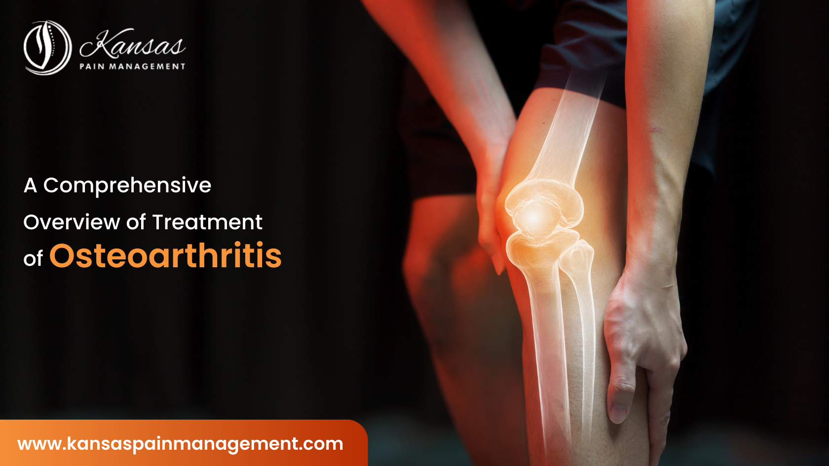 A Comprehensive Overview of Treatment of Osteoarthritis