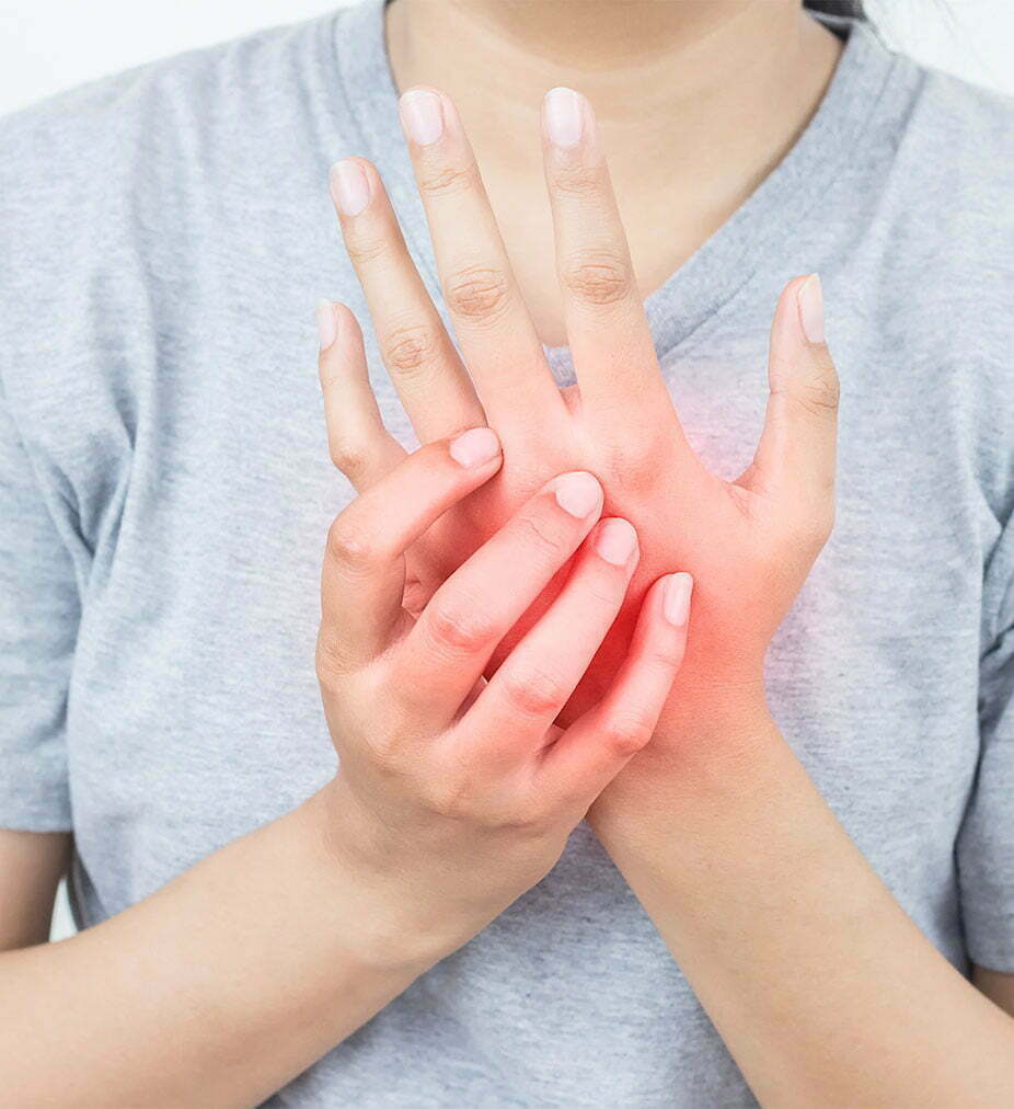 CRPS-img-8