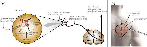 Capsaicin-Patch