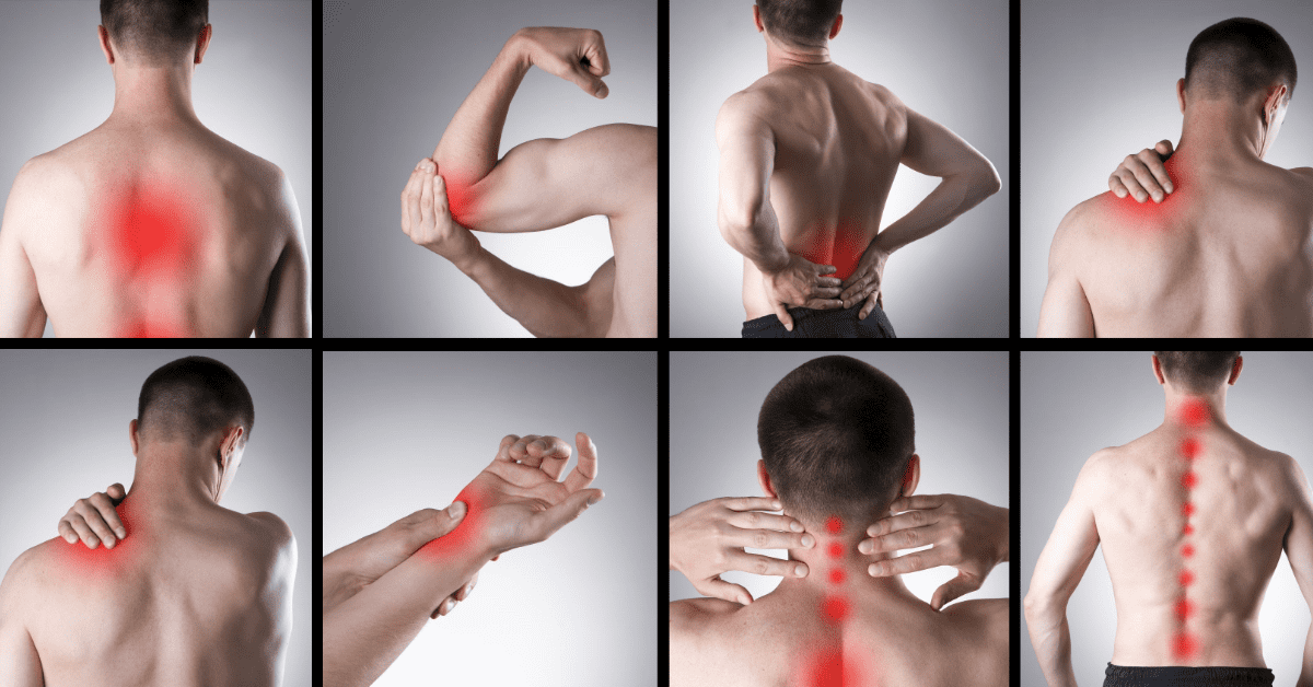 Complex-Regional-Pain-Syndrome