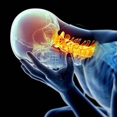 Neck-Pain-And-Headache