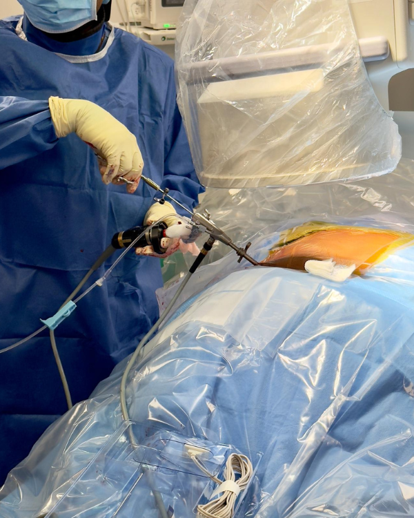Minimally Invasive Discectomy-img2