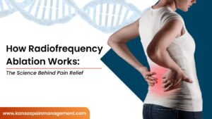 How Radiofrequency Ablation Works: The Science Behind Pain Relief