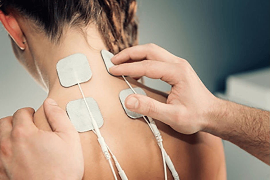 Peripheral Nerve Stimulation
