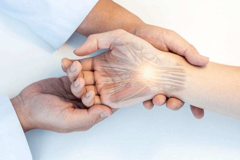 Carpal Tunnel Syndrome