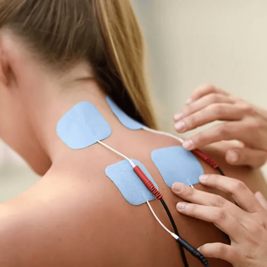 Peripheral Nerve Stimulation